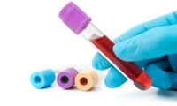 How to Prepare for the Blood Tests for Life Insurance Policies