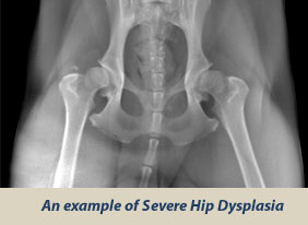Severe Hip Dysplasia