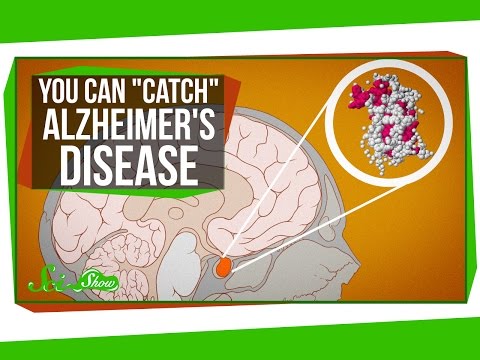 You Can "Catch" Alzheimer's Disease