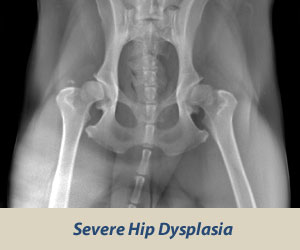 Severe Dysplasia