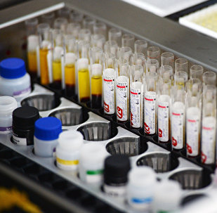 Immunoassay screening lab the blood is tested for infection (hepatitis, syphilis, HIV) on automatic equipment at the Novosibirsk blood donation center