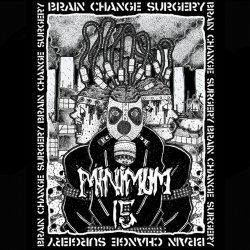 Minimum Limabelast - Brain change surgery (2016)