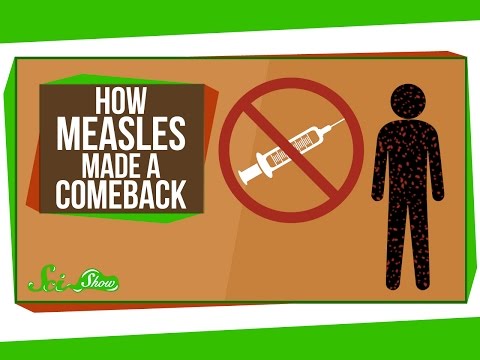 How Measles Made a Comeback