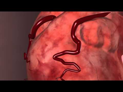 Cardiology: Do You Know The Warning Signs of Heart Disease?