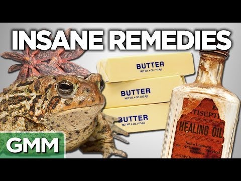 10 Insane Old Time Remedies