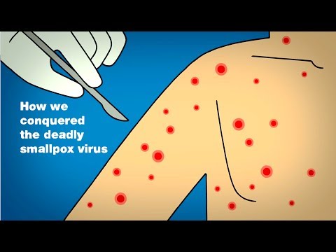 How we conquered the deadly smallpox virus - Simona Zompi