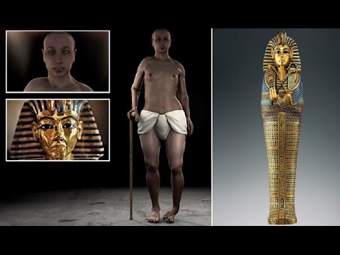 Tutankhamun had girlish hips - clubfoot and buck teeth, also his parents were brother & sister