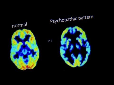 The Brain of a Murderer - Are You Good Or Evil? - Horizon - BBC