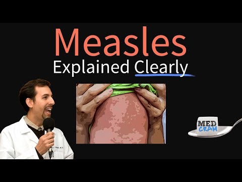 Measles (rubeola) Explained Clearly