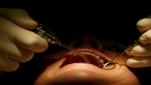 $5b granted for public dental scheme