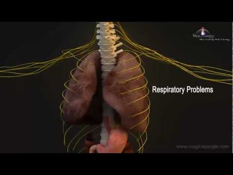 3D Medical Animation - Central Nervous System