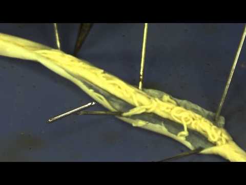 Roundworm dissection