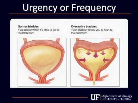 University of Florida Department of Urology: Urodynamics