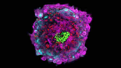 Molecular markers show structures and cell types within a human embryo, shown here 12 days after fertilization. The epiblast, for example, appears in green.