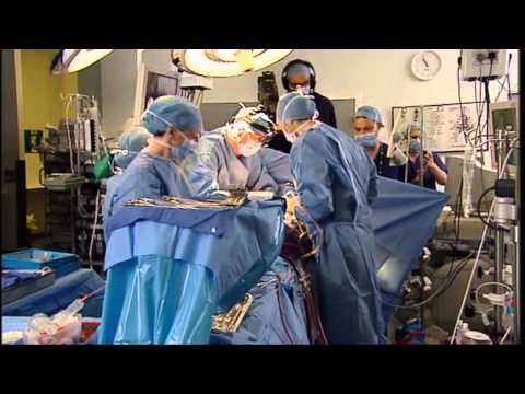 Open Heart Surgery Live