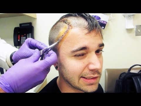 PAINFUL STAPLE REMOVAL (9.30.13 - Day 1614)