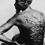 A photograph showing the whipping scars on the back of an African-American slave.