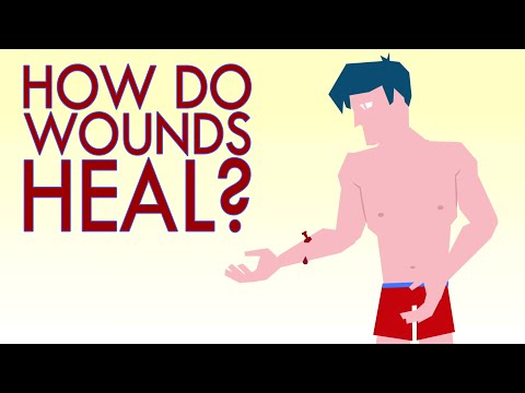 How a wound heals itself - Sarthak Sinha