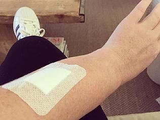 CREDIT: Instagram/Samantha Armytage SAMANTHA Armytage has hit out at owners of aggressive dogs after she was attacked during a afternoon walk late yesterday. The glamorous presenter shared a photo on Instagram shortly after the frightening incident, showing an arm wound covered with a large plaster.