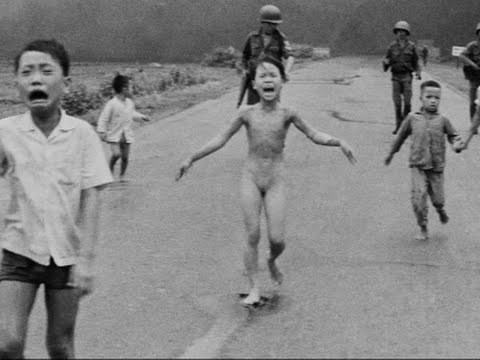 'Napalm Girl’ in AP Photo Undergoes Treatment