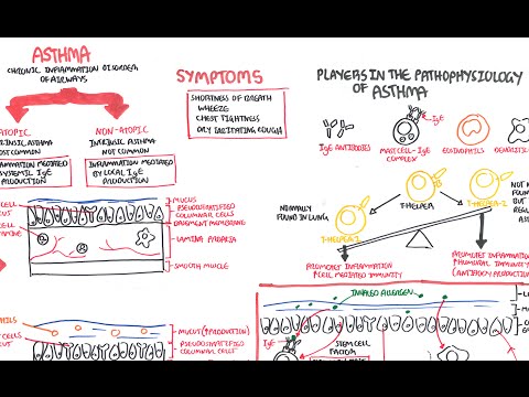 Asthma Pathophysiology