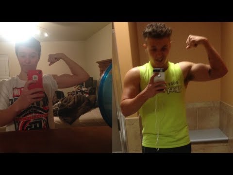 Female To Male Transition - 1 Year On Testosterone