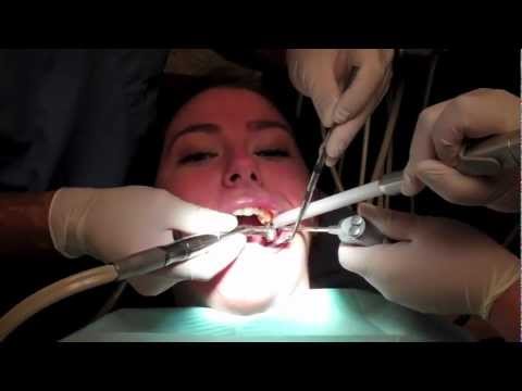 What Is It Like To Get A Filling In Your Tooth With Footage From The Dentists Office