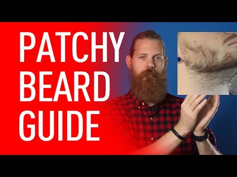 How to Deal With a Patchy Beard