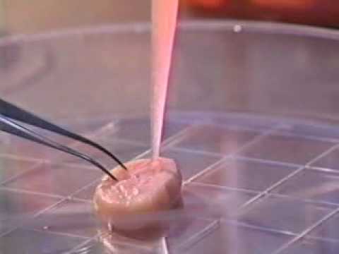 Tissue Engineering -- Building Body Parts