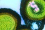 A coloured transmission electron micrograph of a deadly cluster of MRSA Staphylococcus aureus bacteria, resistant to ...