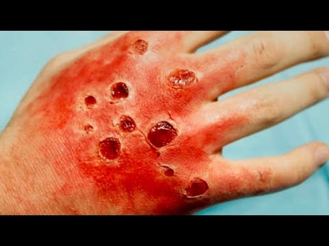 10 Diseases That Will Kill You In A Day