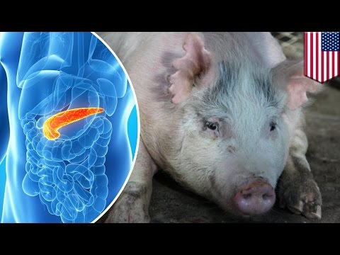 Scientists aim to grow human organs in pigs by creating human-pig embryos