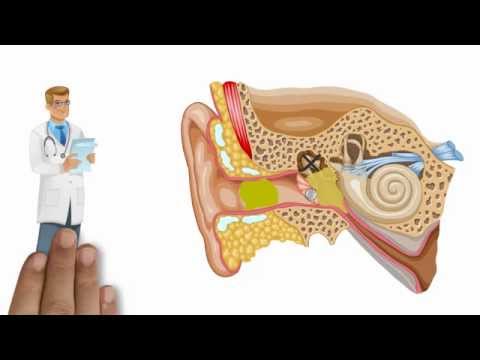 Auditory system