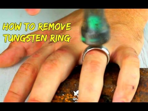 Emergency Removal of a Tungsten Ring