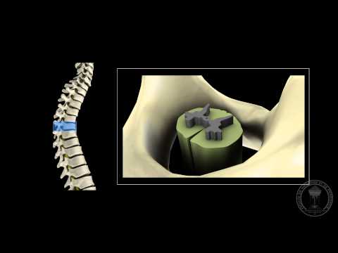 Neuroanatomy - The spinal cord