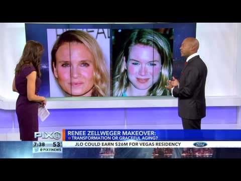 Dr. Michael Jones Featured On PIX11 Morning News - Discusses Renee Zellweger's 'New' Look