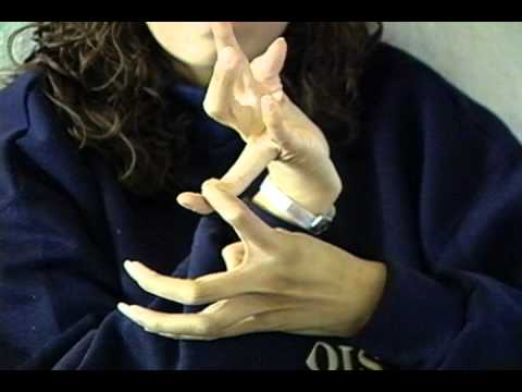 Marfan Syndrome