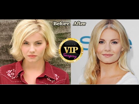 Celebrity Plastic Surgery | Elisha Cuthbert Plastic Surgery Before And After