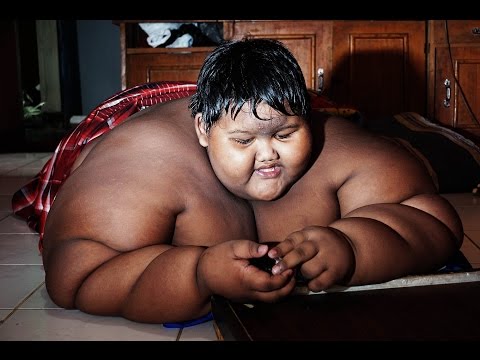 423lb 10-Year-Old Has Life Threatening Obesity