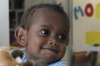 Charlie Rao, 22 months, from the Solomon Islands, with his mother Mary Ribe, before his life-changing surgery at The ...