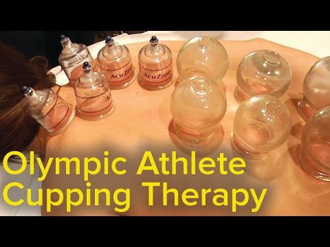 Chinese Cupping Therapy - Relaxing, Healing and Pain Relieving | ASMR Triggers