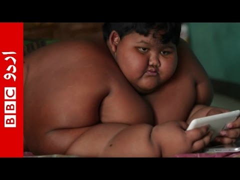 World’s fattest child from Indonesia .BBC Urdu