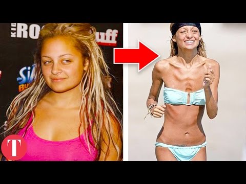 10 SHOCKING Weight Changes Of Famous People