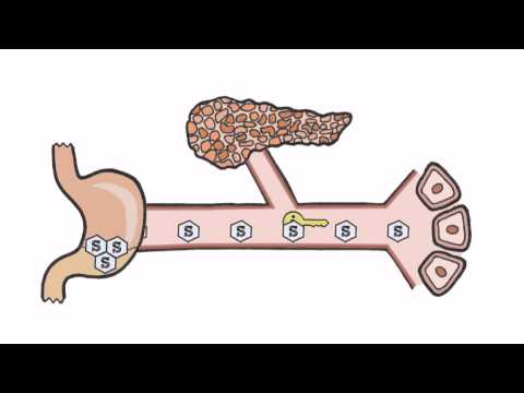 Diabetes - made simple