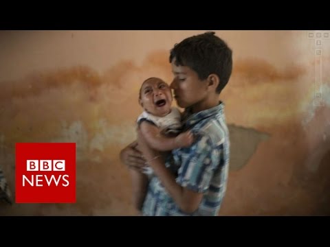 Brazil Zika outbreak: What is happening to Brazil's babies? BBC News