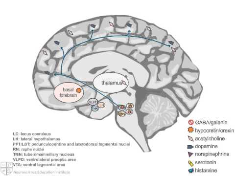 Neuropathology and Treatment of Hypersomnia