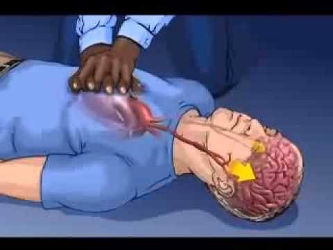 New CPR Guidelines For Adults must watch