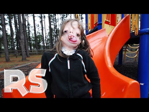 Juliana: The Girl With The New Face (Documentary) - Real Stories