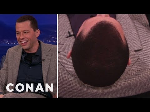 Jon Cryer Comes Clean On His Roll-On Hair