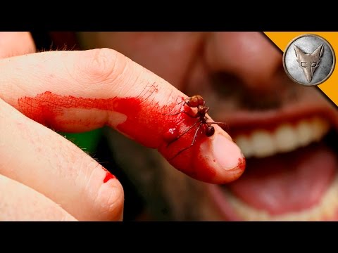 CRAZY ANT BITE!